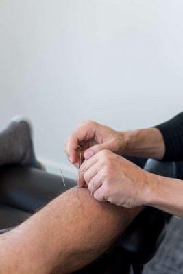 Acupuncture Indianapolis IN