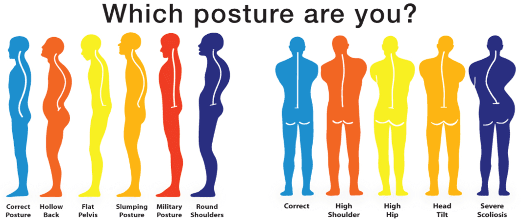 which-posture-are-you