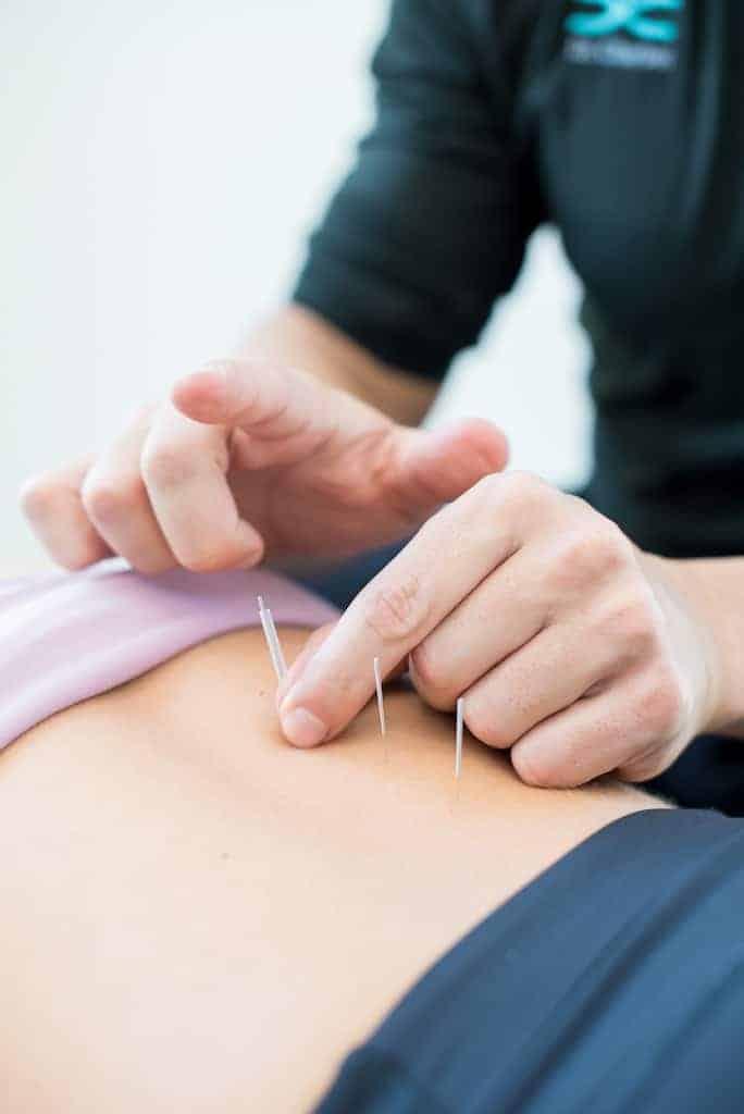 Acupuncture In Indianapolis
