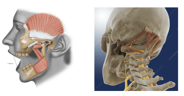 Treatment for TMJ Pain